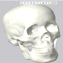 基于逆向工程的头骨修复设计及#D打印快速成型技术